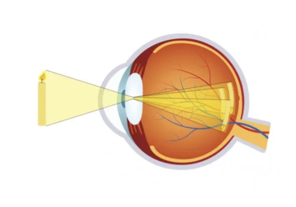 Oogkliniek Zeeland Folder Astigmatisme