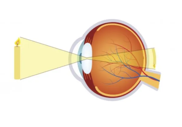 Oogkliniek Zeeland Folder Hypermetropie