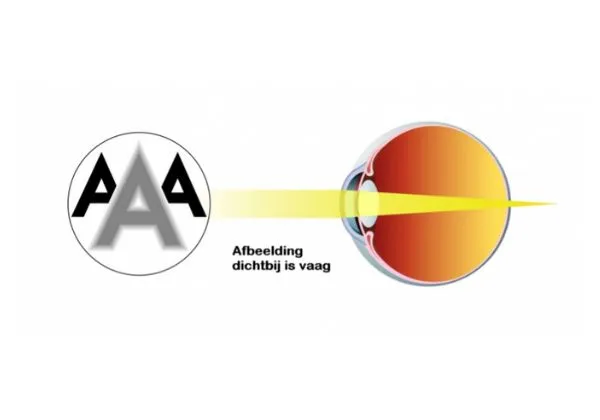 Oogkliniek Zeeland Folder Presbyopie